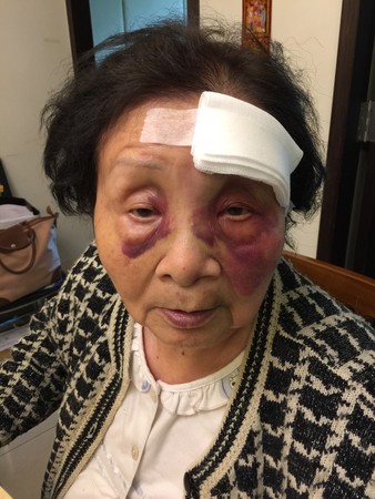 包含老妇人球员因伤缺席下一场比赛的词条 包含老妇人球员因伤缺席下一场比赛的词条